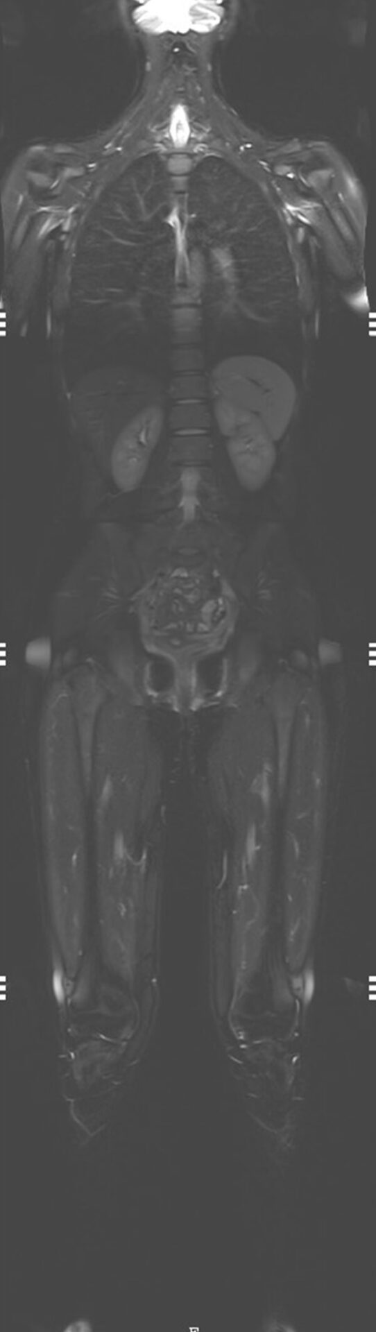 Kernspintomographie-Ganzkörper MRT Kernspintomographie-Ganzkörper MRT